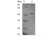 Recombinant Human ATXN2 protein (GST tag)