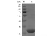 Recombinant Human Pro-ADM protein (GST tag)