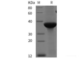 Recombinant Human Glucagon-like peptide 1/GLP-1 protein (GST tag)