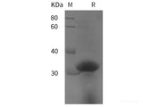 Recombinant Human Collagen alpha-1(I)chain/COL1A1 protein (TRX,His tag)