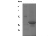 Recombinant Human UCP1 protein (His tag)