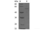 Recombinant Human PSAP protein (His tag)