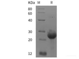 Recombinant Human ABL1/c-Abl protein (His tag)