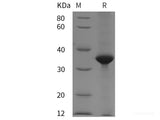 Recombinant Human MCM3 protein (His tag)