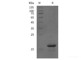 Recombinant Human NT protein (His tag)