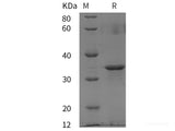 Recombinant Human VASPIN protein (GST tag)