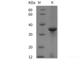 Recombinant Human GAL protein (GST tag)