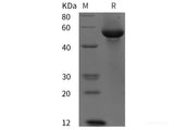 Recombinant Human G6PD protein (His tag)