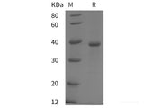 Recombinant Human DCN protein (His tag)