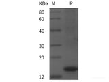 Recombinant Human CFHR1 protein (His tag)