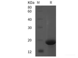 Recombinant Human Podocin/NPHS2 protein (His tag)