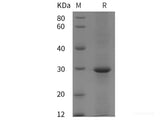 Recombinant Human Pancreatic lipase/PL protein (His tag)