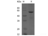 Recombinant Human MASP1 protein (His tag)