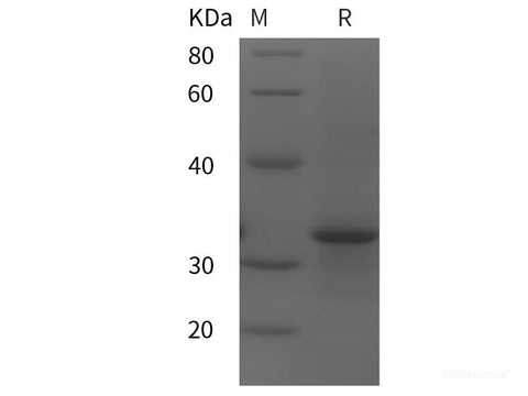 Recombinant Human COL1α2 protein (His tag)