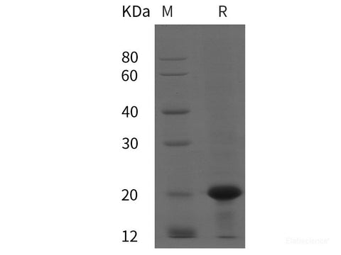 Recombinant Human MMP-7 protein (His tag)