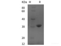 Recombinant Human GRP78 protein (His tag)