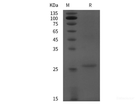 Recombinant Human LTF/LF protein (His tag)