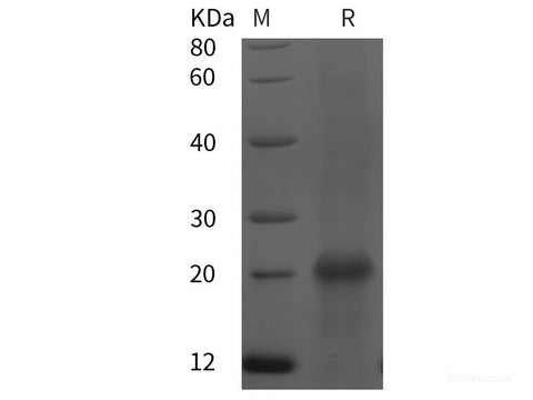 Recombinant Human ESM1 protein (His tag)