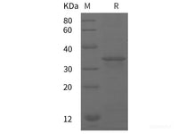 Recombinant Human RETN protein (GST tag)