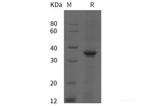 Recombinant Human PⅢNP protein (His tag)