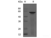 Recombinant Human DES protein (His tag)