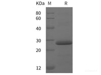 Recombinant Human FLNC protein (His tag)