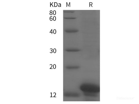 Recombinant Human APOH protein (His tag)