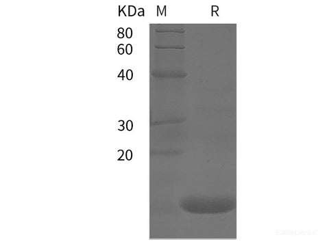 Recombinant Human TNFa protein (Avi, His tag)