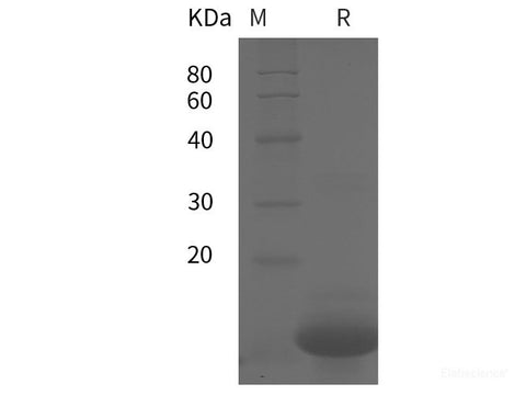 Recombinant Human IL18 N terminal protein (Avi,His tag)