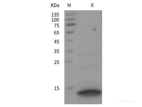 Recombinant Human CXCL14 protein (His tag)