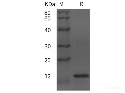 Recombinant Human CCL28 protein (His tag)