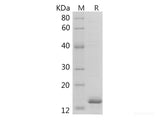 Recombinant Human Galectin-1/LGALS1 protein (His tag)