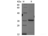 Recombinant Human PD-L1/B7-H1/CD274 protein (His tag)