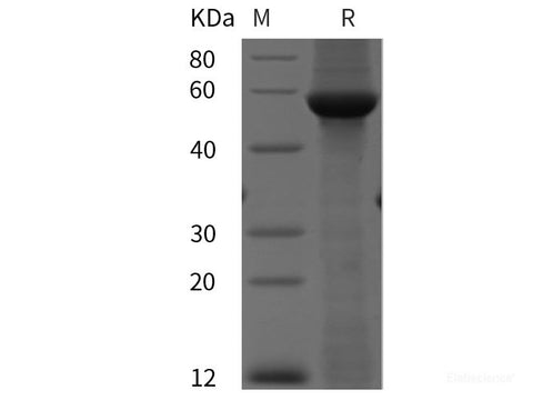 Recombinant Human MMP1 protein (His tag)