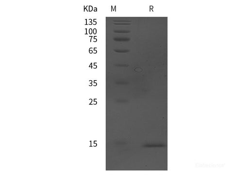 Recombinant Human Nectin-4/NECTIN4 protein (His tag)