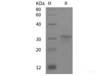 Recombinant Human SMOC2 protein (His tag)