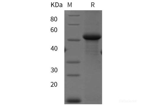 Recombinant Human Calnexin/CANX protein (His tag)