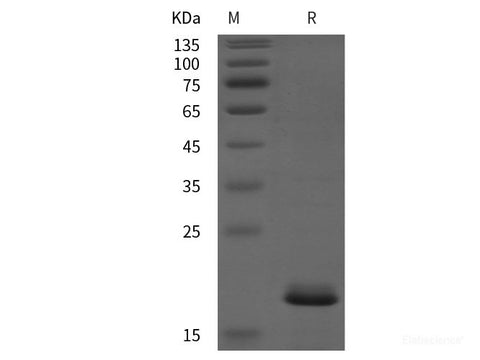 Recombinant Human TRAPPC8 protein (His tag)