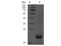 Recombinant Human TRAPPC6A/TPC6A protein (His tag)