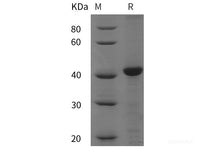 Recombinant CANX/Calnexin protein (His tag)