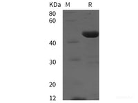 Recombinant Human PAI-2 protein (His tag)