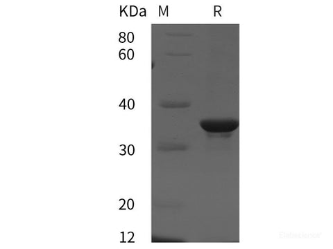 Recombinant Human cyclin D3/CCND3 protein (His tag)