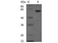 Recombinant Human Cyclin A2/CCNA2 protein (His tag)