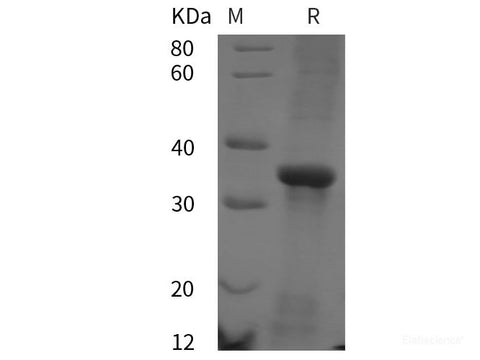 Recombinant Human CD38/SCARB3 protein (His tag)