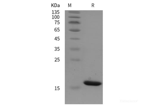 Recombinant Human ubc/Polyubiquitin-C protein (His tag)