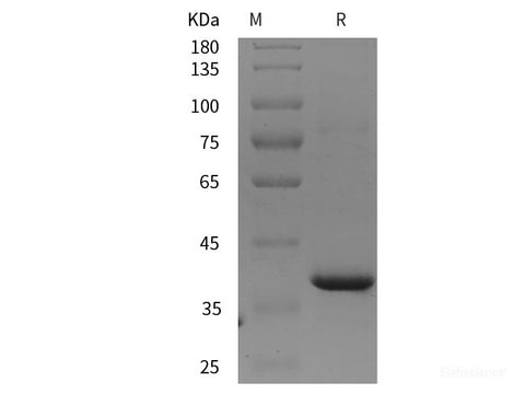 Recombinant Human MMP-2/CLG4A protein (His tag)