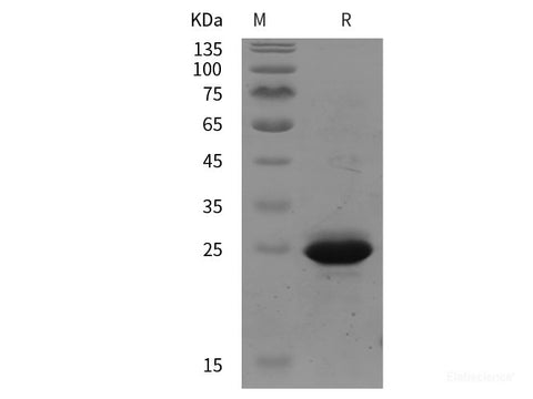 Recombinant Human CD146/MCAM protein (His tag)