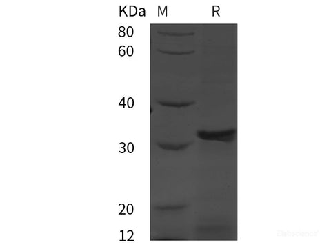 Recombinant Human PSMA / FOLH1 protein (His tag)