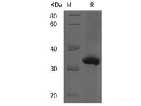 Recombinant Human KLK3 protein (His tag)