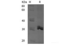 Recombinant Human KLK2 protein (His tag)